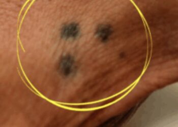 Zie jij iemand met drie puntjes op zijn hand? Dit is waarom je voorzichtig moet zijn!